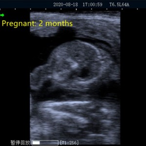 Digital B Ultrasound For Veterinary vUlt A20