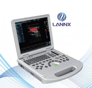Laptop color doppler ultrasound scanner uDult L5Plus