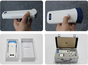 Single Head Convex Array Wireless Ultrasound Probe uRason W5
