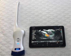 2 in 1 Probe Intracavitary & Linear Array Wireless Ultrasound uRason W9