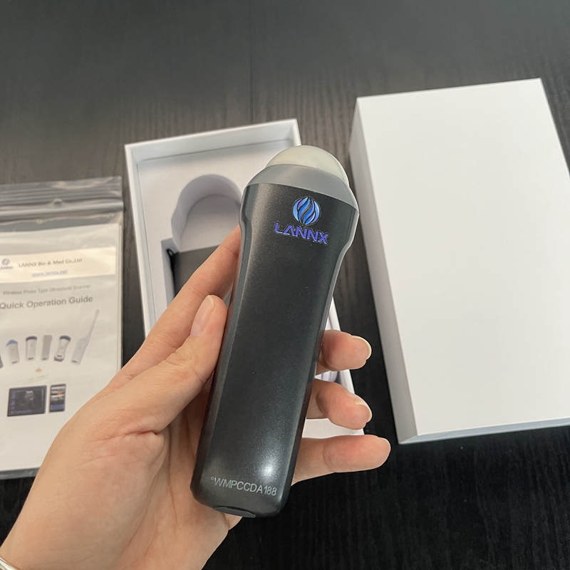 mobile ultrasound at home