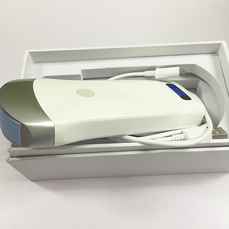mobile ultrasound atlanta