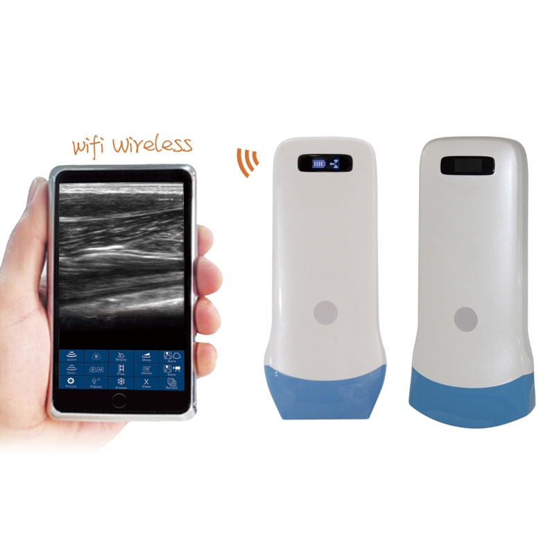 mobile ultrasound cost