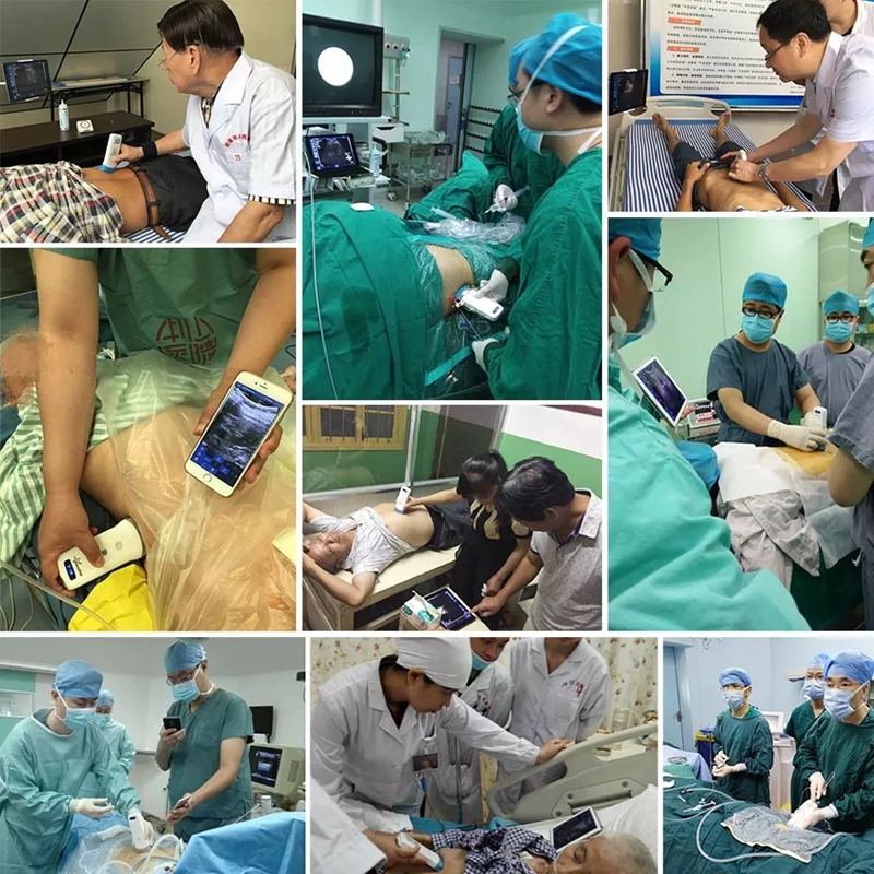 mobile ultrasound free