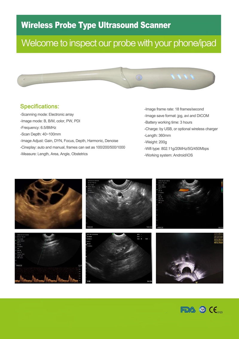 transvaginal ultrasound cost