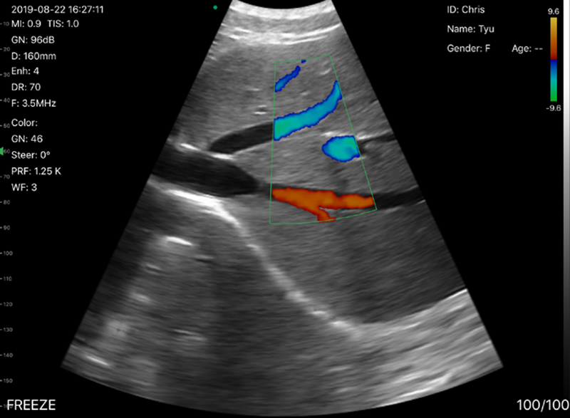 ultrasound probe amazon