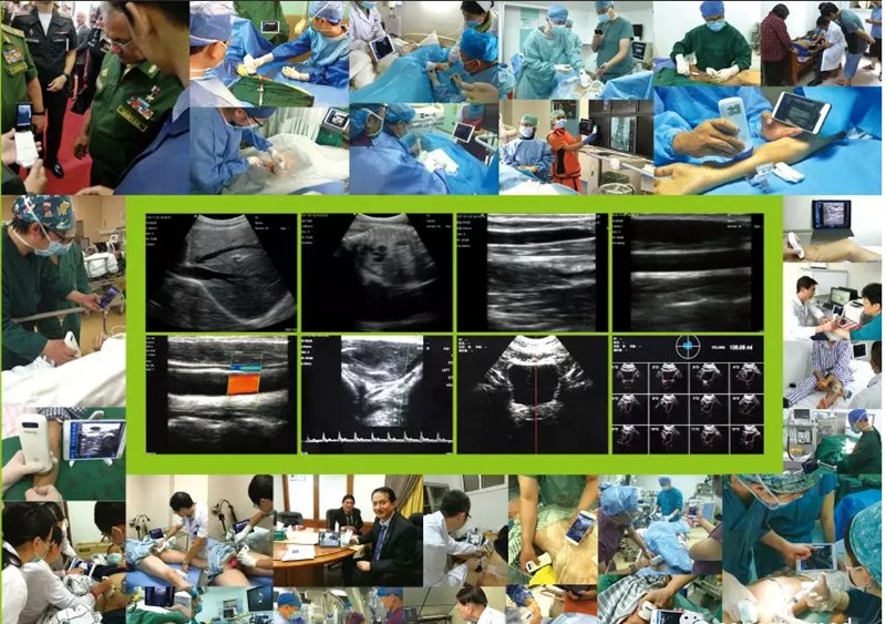 ultrasound probes and their uses