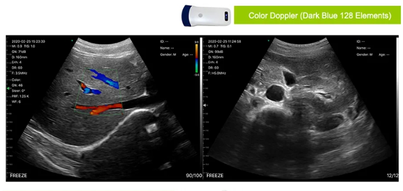 ultrasound wireless wifi