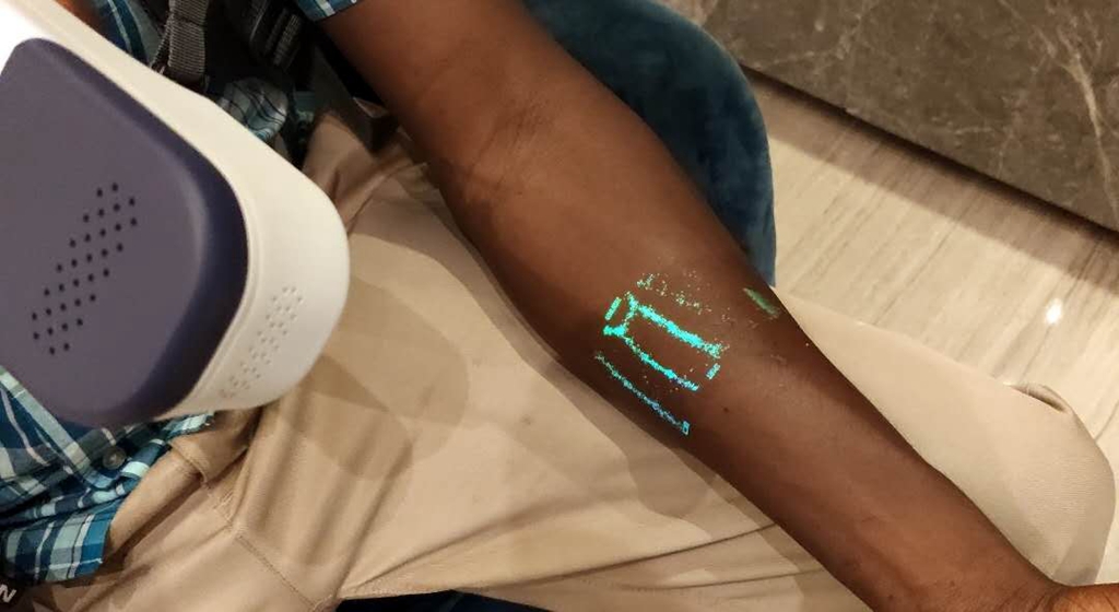 vein finder device how does it work