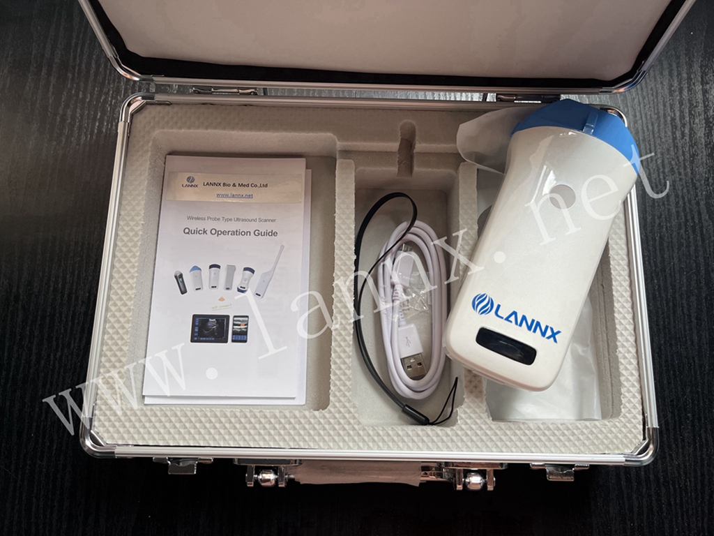 wifi ultrasound buy