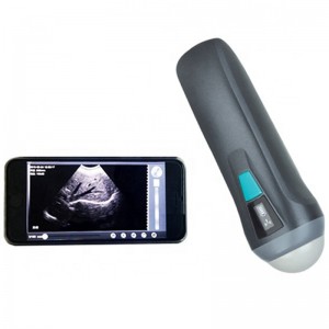 Single Head Wireless Ultrasound uRason W1
