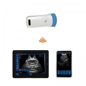 Single Head Convex Array Wireless Ultrasound Probe uRason W5