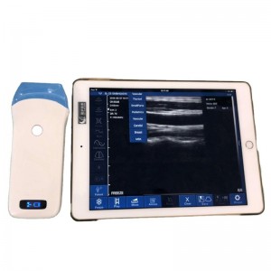Single Head Linear Array Wireless Ultrasound Probe uRason W6
