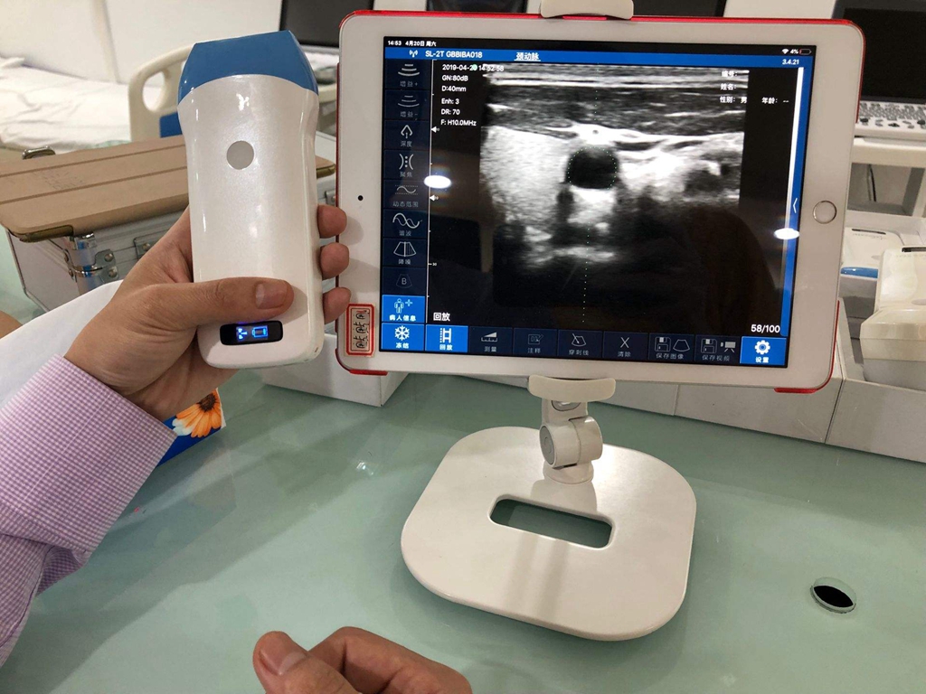wireless ultrasound for iphone