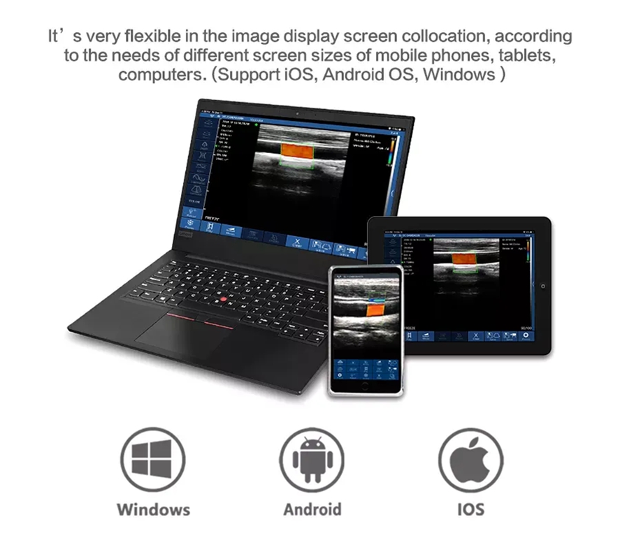 wireless ultrasound for iphone