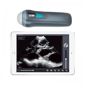 Single Head Wireless Ultrasound uRason W1