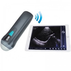 Single Head Wireless Ultrasound uRason W1