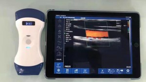 Dual Head Convex & Linear Array Wireless Ultrasound Probe uRason W7