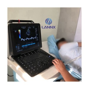 Portable robust cardiovascular ultrasound system with cardiac capability uDult P8