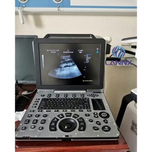 Portable robust cardiovascular ultrasound system with cardiac capability uDult P8