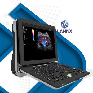 Portable robust cardiovascular ultrasound system with cardiac capability uDult P8