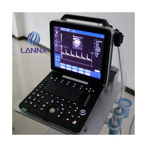Portable robust cardiovascular ultrasound system with cardiac capability uDult P8