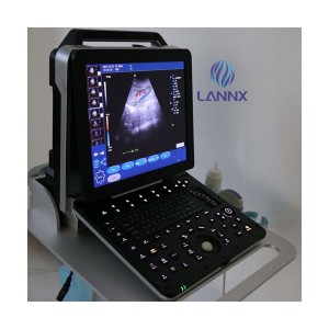 Portable robust cardiovascular ultrasound system with cardiac capability uDult P8