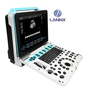 Usg 3D/4D/5D Portable color doppler ultrasound scanner uDult P5 PRO