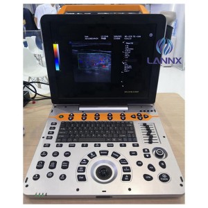 5d ultraschall color doppler diagnostic ultrasound system uDult P8 Lite