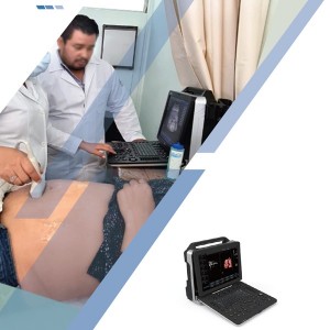 Usg 3D/4D/5D Portable color doppler ultrasound scanner uDult P5 PRO