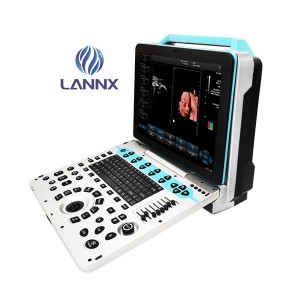 Usg 3D/4D/5D Portable color doppler ultrasound scanner uDult P5 PRO