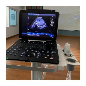 Usg 3D/4D/5D Portable color doppler ultrasound scanner uDult P5 PRO
